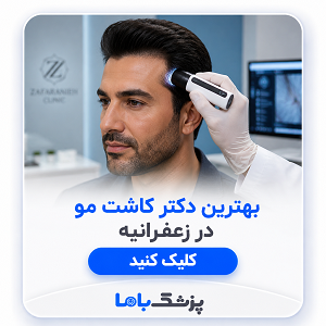 بهترین دکتر کاشت مو در زعفرانیه