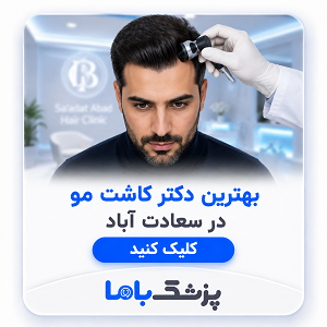 بهترین دکتر کاشت مو در سعادت آباد