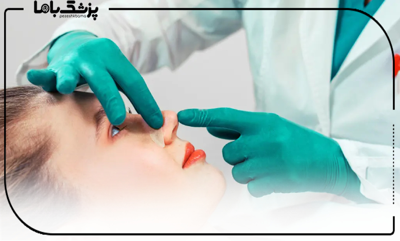بهترین جراح بینی در کرمانشاه