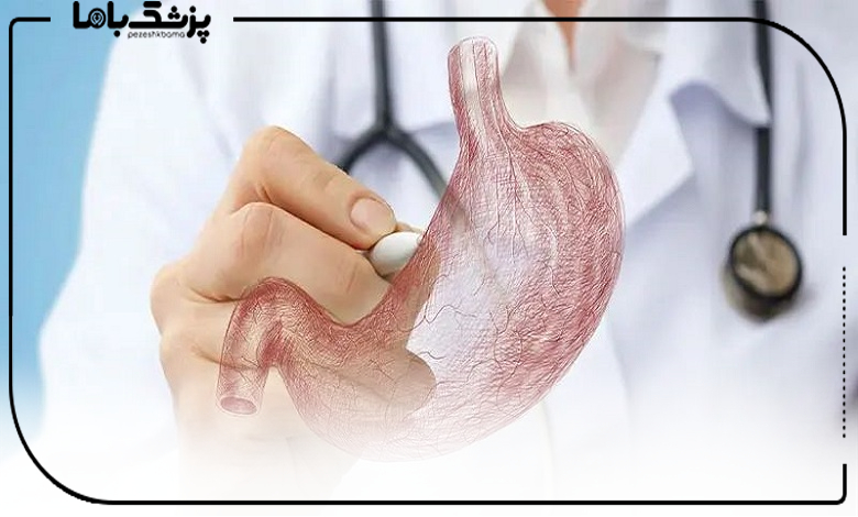بوتاکس معده برای چه افرادی بیشتر انجام می شود؟