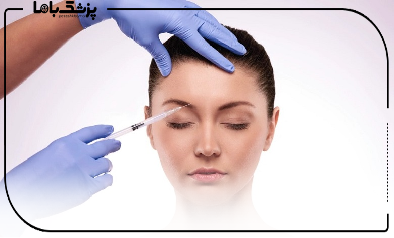 راهنمای انتخاب بهترین دکتر بوتاکس در اندیشه