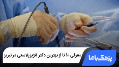 بهترین دکتر آنژیوپلاستی در تبریز