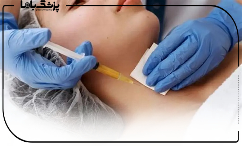 نتایج فیلر بادی چقدر ماندگار است؟