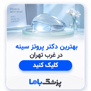 بهترین دکتر پروتز سینه در غرب تهران