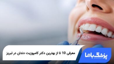 بهترین دکتر کامپوزیت دندان در تبریز
