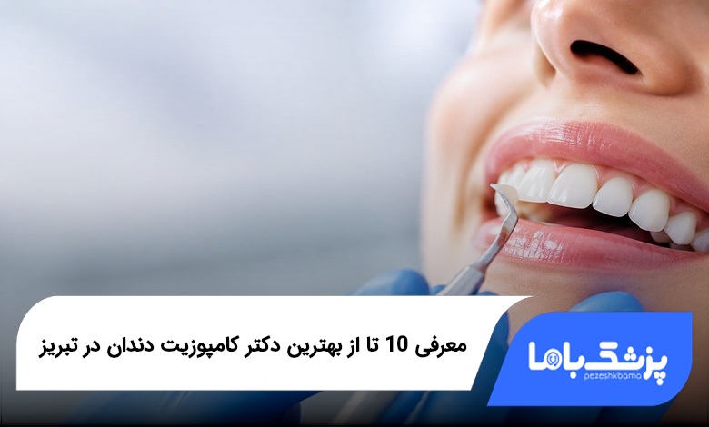 بهترین دکتر کامپوزیت دندان در تبریز
