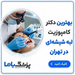 بهترین دکتر کامپوزیت لبه شیشه ای در تهران