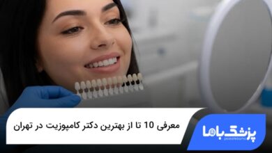 بهترین دکتر کامپوزیت در تهران
