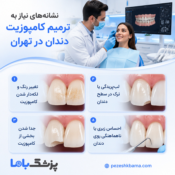 نشانههای نیاز به ترمیم کامپوزیت دندان در تهران