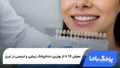 بهترین دندانپزشک زیبایی و ترمیمی در تبریز