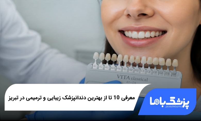 بهترین دندانپزشک زیبایی و ترمیمی در تبریز