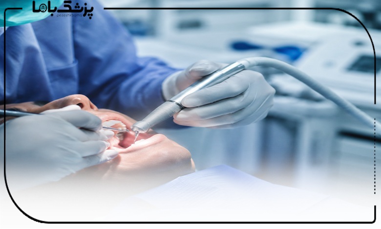 چه زمانی باید به بهترین جراح دندانپزشک در تبریز مراجعه کنیم?
