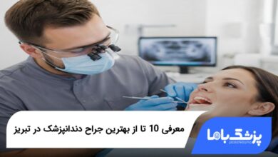 بهترین جراح دندانپزشک در تبریز
