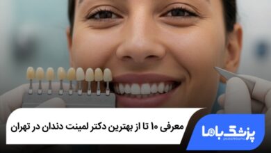 بهترین دکتر لمینت دندان در تهران