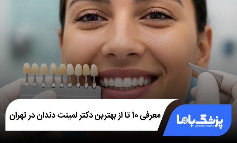 بهترین دکتر لمینت دندان در تهران
