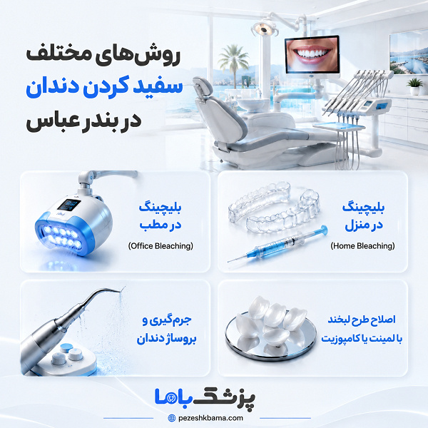 روشهای مختلف سفید کردن دندان در بندر عباس