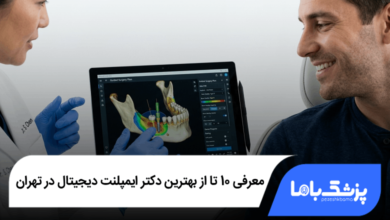 بهترین دکتر ایمپلنت دیجیتال در تهران