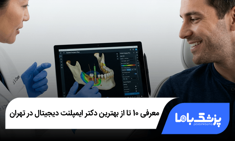 بهترین دکتر ایمپلنت دیجیتال در تهران