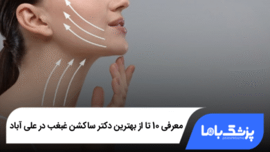 بهترین دکتر ساکشن غبغب در علی آباد