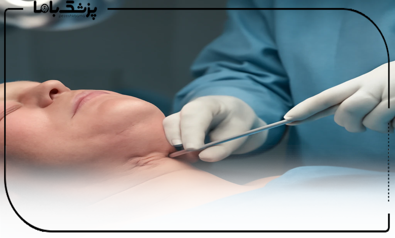 بهترین دکتر ساکشن غبغب در اندیشه چه تخصصی دارد؟