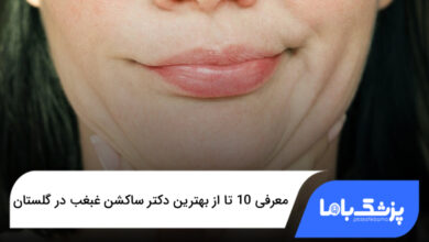 بهترین دکتر ساکشن غبغب در گلستان
