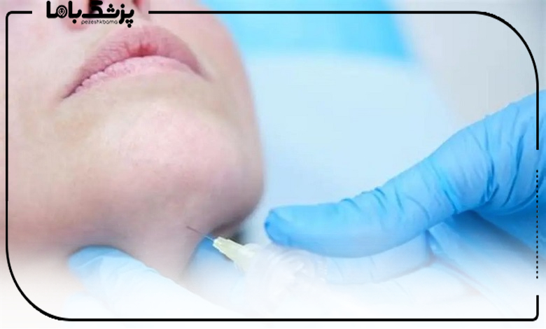 مراحل ساکشن غبغب در خانی آباد