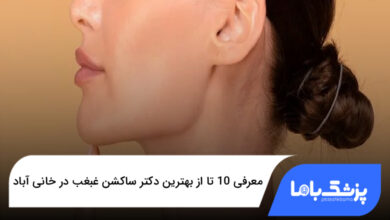 بهترین دکتر ساکشن غبغب در خانی آباد
