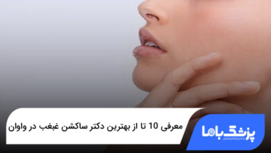 بهترین دکتر ساکشن غبغب در واوان
