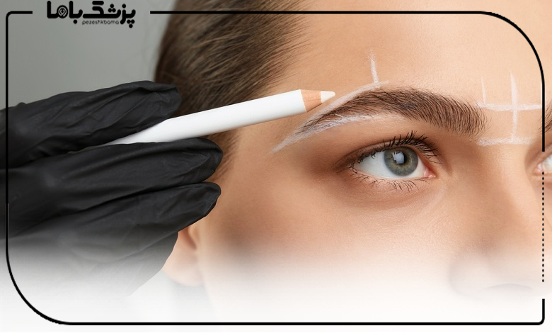 رازهای ماندگاری دائمی کاشت ابرو