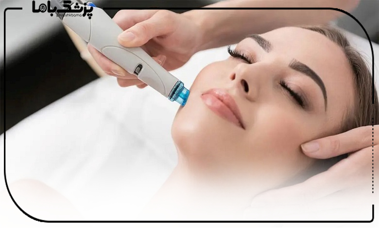 فیشیال پوست برای چه کسانی مناسب است؟