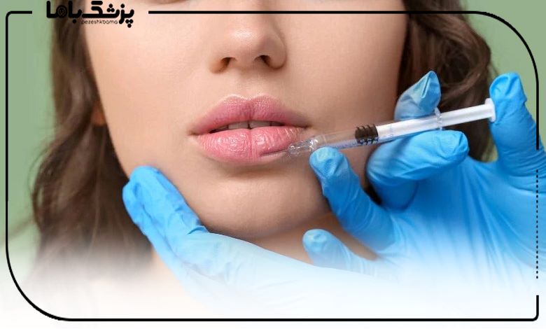 محبوب ترین نواحی صورت برای تزریق ژل