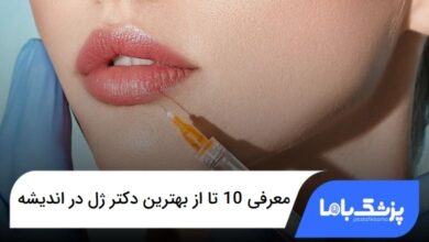 بهترین دکتر ژل در اندیشه