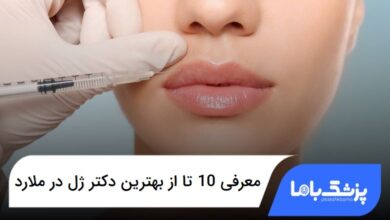 بهترین دکتر ژل در ملارد