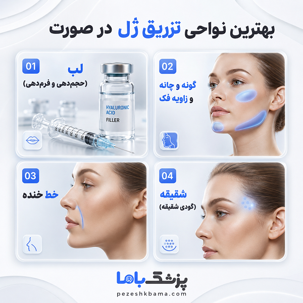 تزریق ژل یا بوتاکس؟ تفاوتهایی که قبل از انتخاب باید بدانید