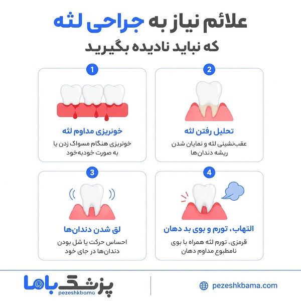 علائم نیاز به جراحی لثه که نباید نادیده بگیرید