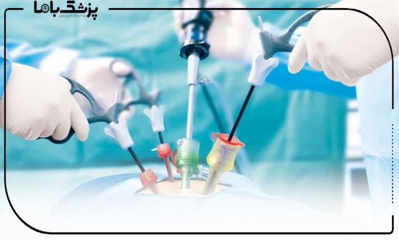 چگونه بهترین جراح لاپاراسکوپی در تبریز را انتخاب کنیم؟