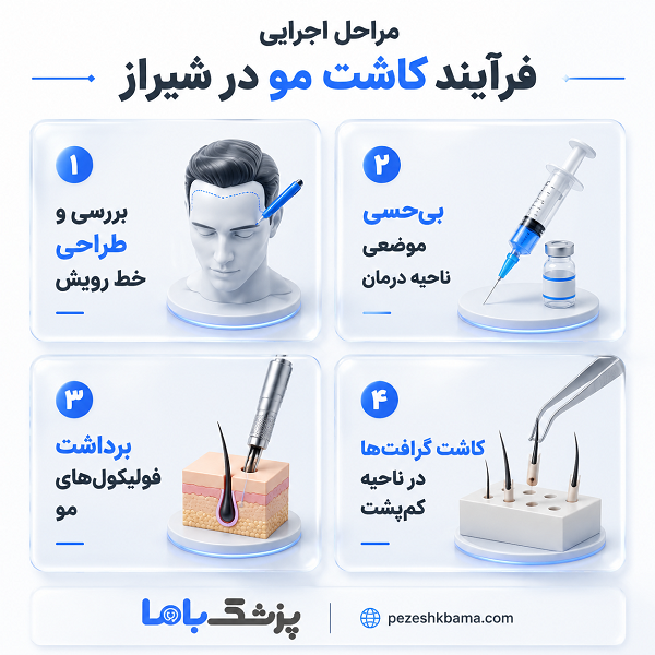 جدیدترین روشهای کاشت مو در شیراز