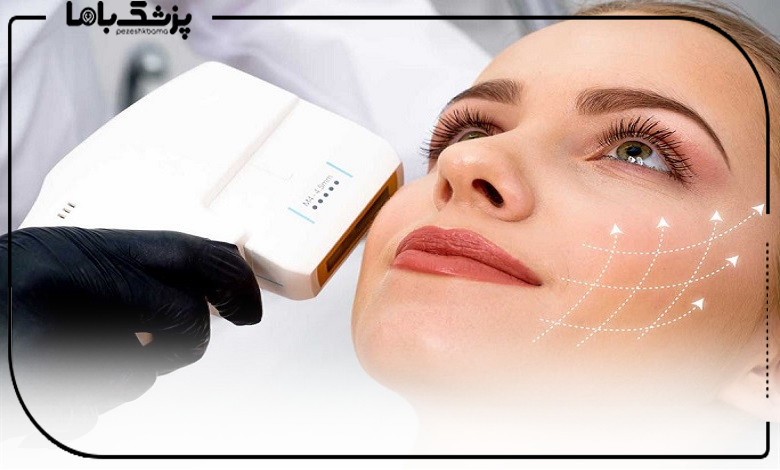 به طور معمول چند جلسه هایفوتراپی لازم است؟