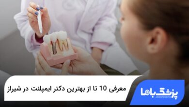 بهترین دکتر ایمپلنت در شیراز