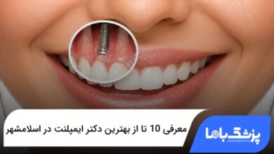 بهترین دکتر ایمپلنت در اسلامشهر