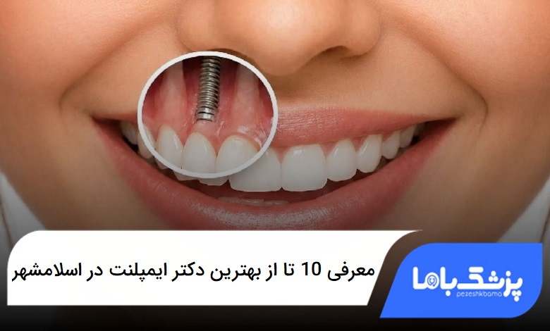 بهترین دکتر ایمپلنت در اسلامشهر