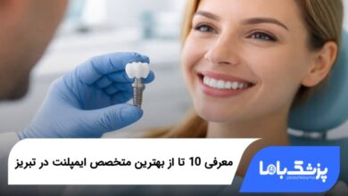 بهترین متخصص ایمپلنت در تبریز
