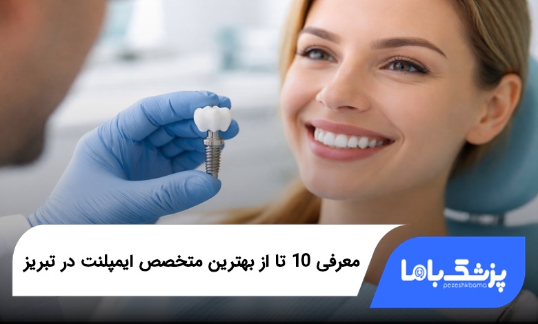 بهترین متخصص ایمپلنت در تبریز