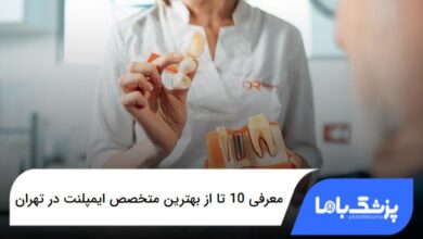 بهترین متخصص ایمپلنت در تهران