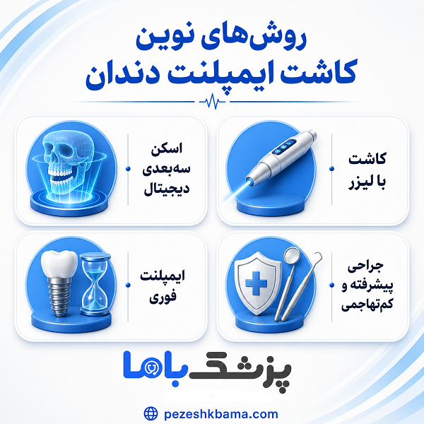 مهم ترین نکات در انتخاب متخصص ایمپلنت در تهران