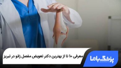 بهترین دکتر تعویض مفصل زانو در تبریز