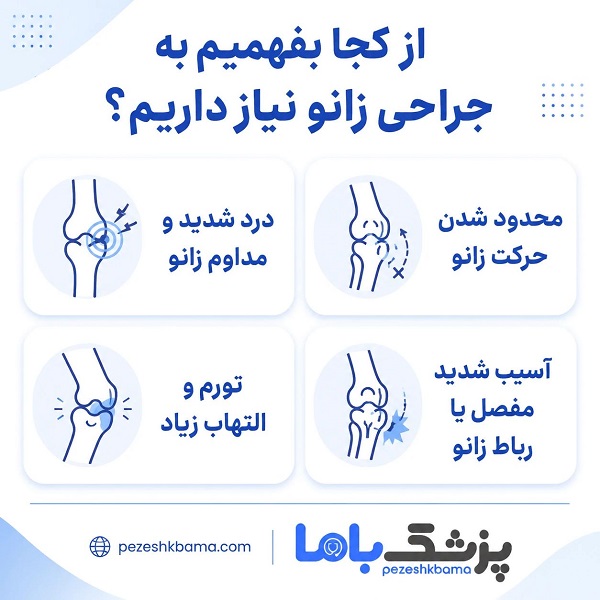 از کجا بفهمیم به جراحی زانو نیاز داریم؟