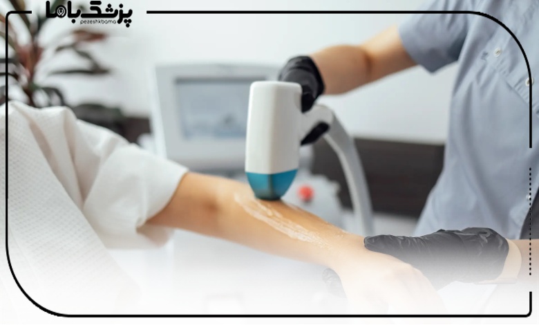 لیزر موهای زائد در اصفهان با دستگاه پیشرفته