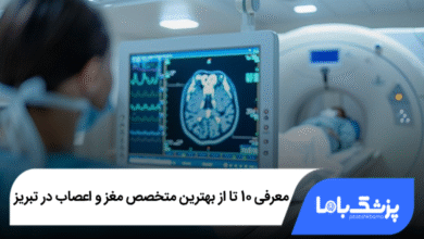 بهترین متخصص مغز و اعصاب در تبریز