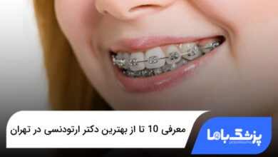 بهترین دکتر ارتودنسی در تهران